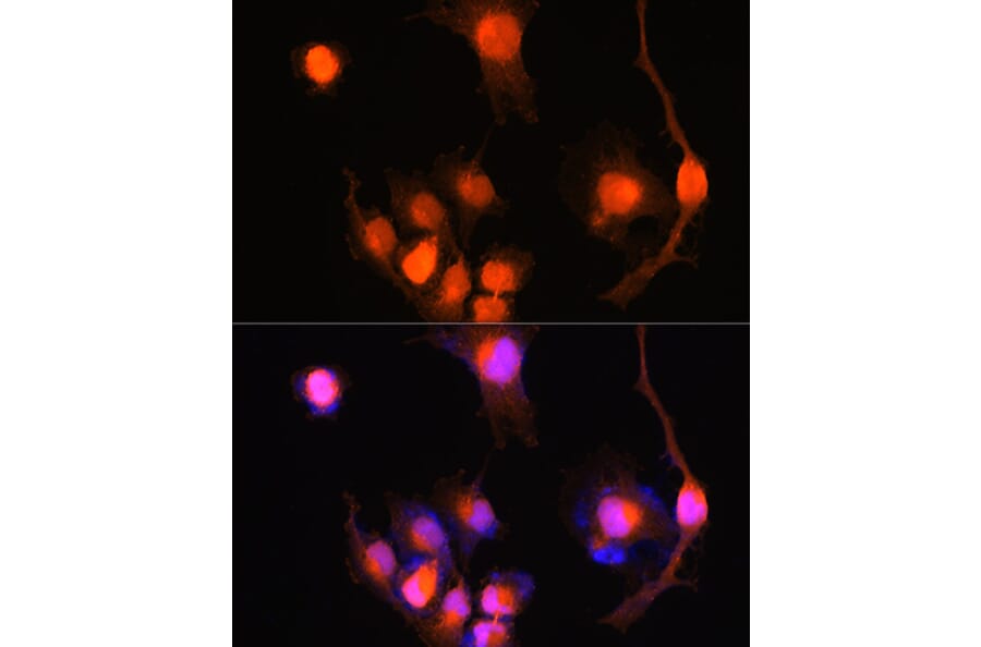 Immunofluorescence - Anti-PGP9.5 Antibody (A13896) - Antibodies.com