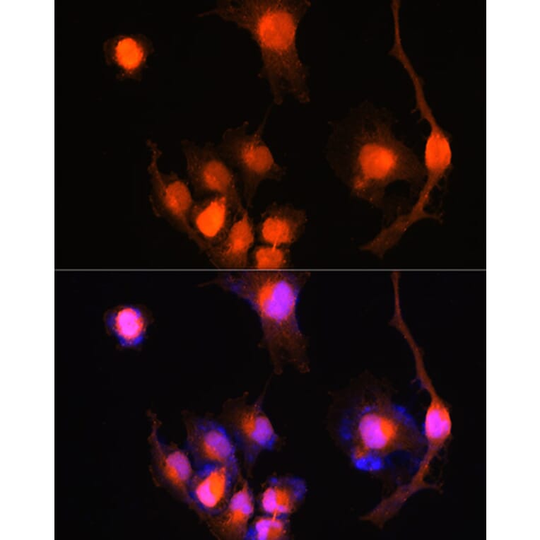 Immunofluorescence - Anti-PGP9.5 Antibody (A13896) - Antibodies.com