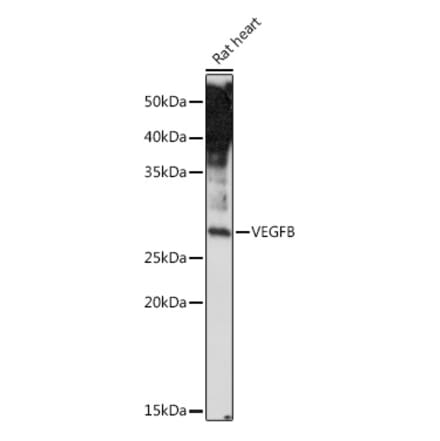 Western Blot - Anti-VEGFB Antibody (A13897) - Antibodies.com