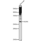 Western Blot - Anti-VEGFB Antibody (A13897) - Antibodies.com