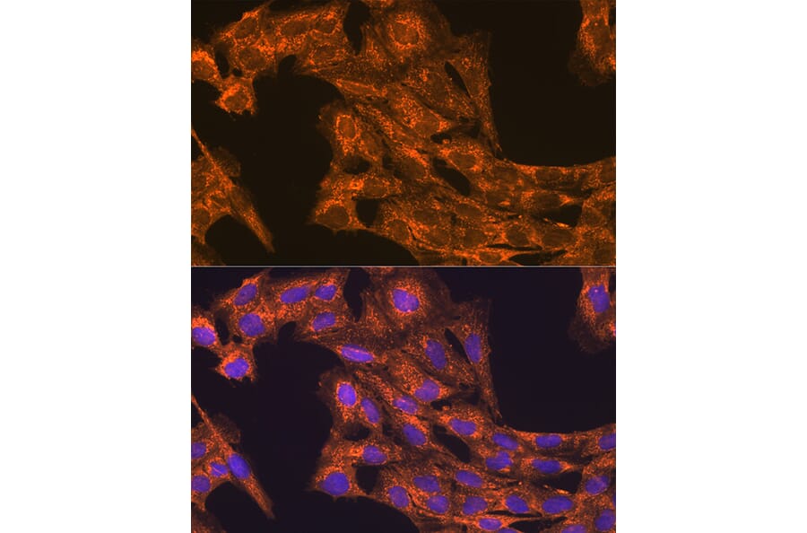Immunofluorescence - Anti-VEGFB Antibody (A13897) - Antibodies.com