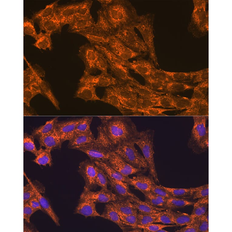 Immunofluorescence - Anti-VEGFB Antibody (A13897) - Antibodies.com