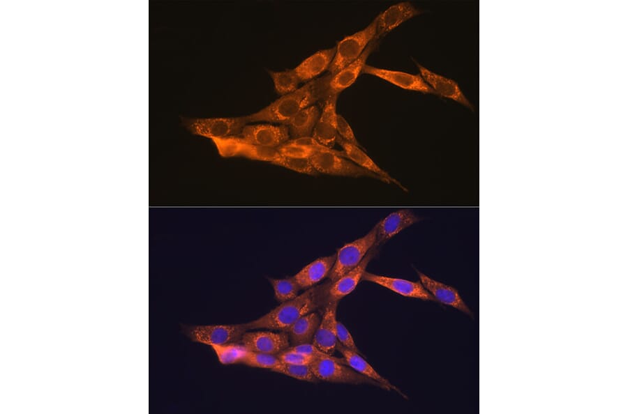 Immunofluorescence - Anti-VEGFB Antibody (A13897) - Antibodies.com