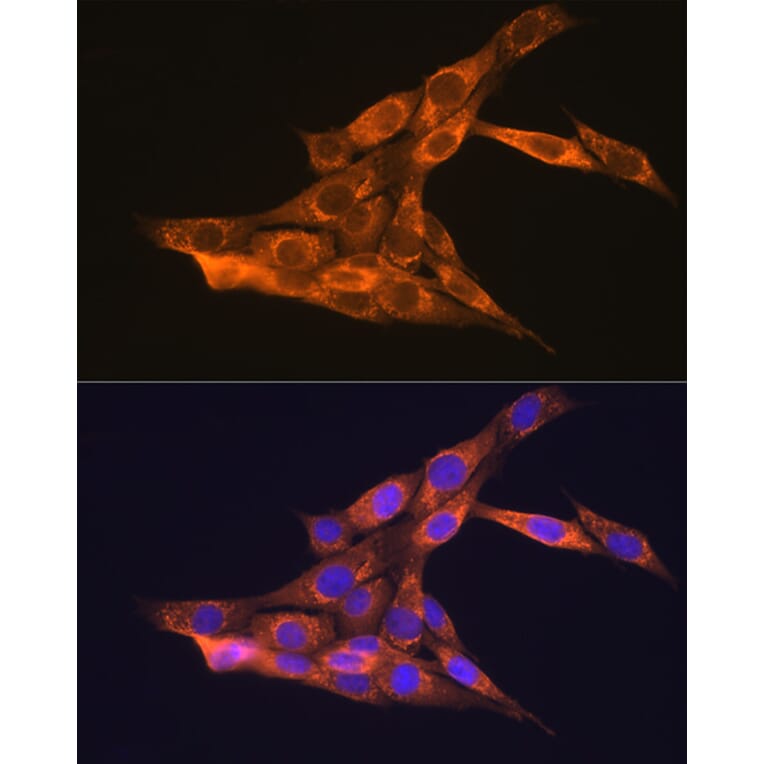 Immunofluorescence - Anti-VEGFB Antibody (A13897) - Antibodies.com