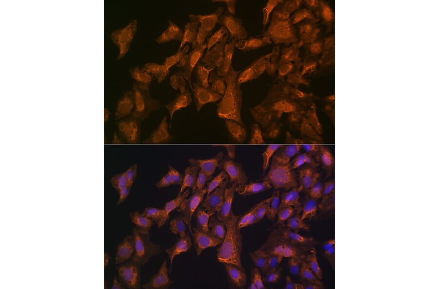 Immunofluorescence - Anti-VEGFB Antibody (A13897) - Antibodies.com