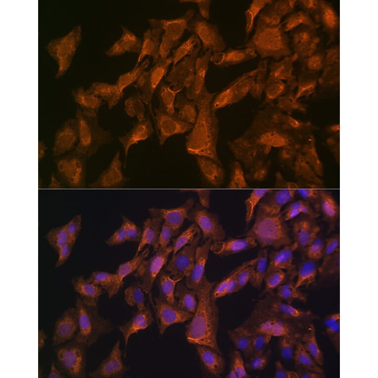 Immunofluorescence - Anti-VEGFB Antibody (A13897) - Antibodies.com