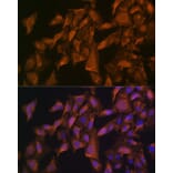 Immunofluorescence - Anti-VEGFB Antibody (A13897) - Antibodies.com