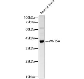 Western Blot - Anti-Wnt5a Antibody (A13898) - Antibodies.com