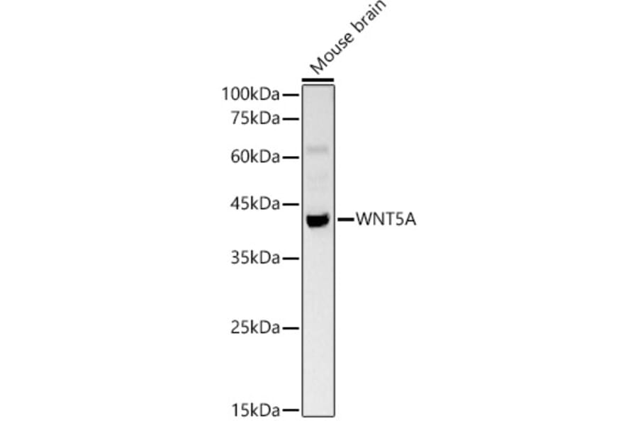 Western Blot - Anti-Wnt5a Antibody (A13898) - Antibodies.com