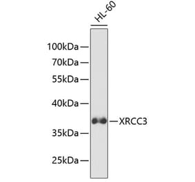 Western Blot - Anti-XRCC3 Antibody (A13899) - Antibodies.com