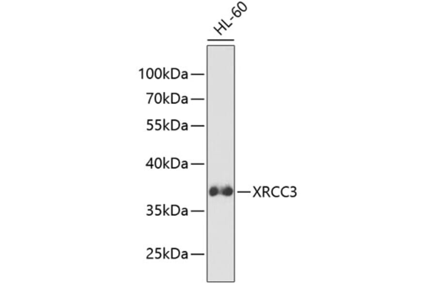 Western Blot - Anti-XRCC3 Antibody (A13899) - Antibodies.com