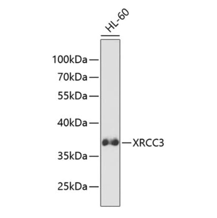 Western Blot - Anti-XRCC3 Antibody (A13899) - Antibodies.com