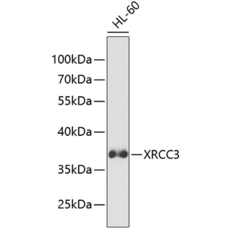 Western Blot - Anti-XRCC3 Antibody (A13899) - Antibodies.com