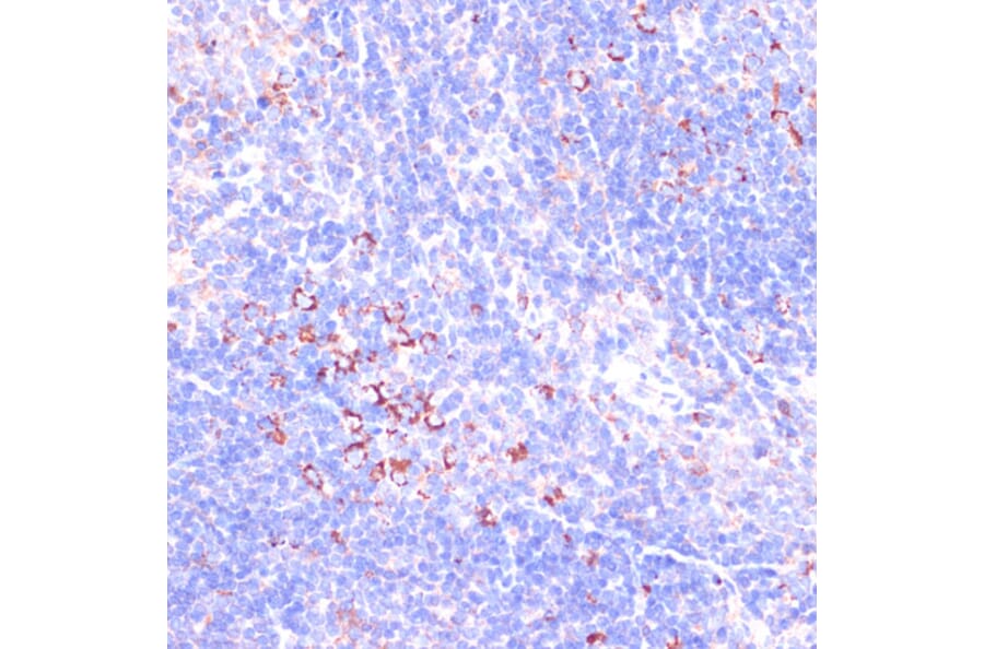 Immunohistochemistry - Anti-Zyxin Antibody (A13900) - Antibodies.com