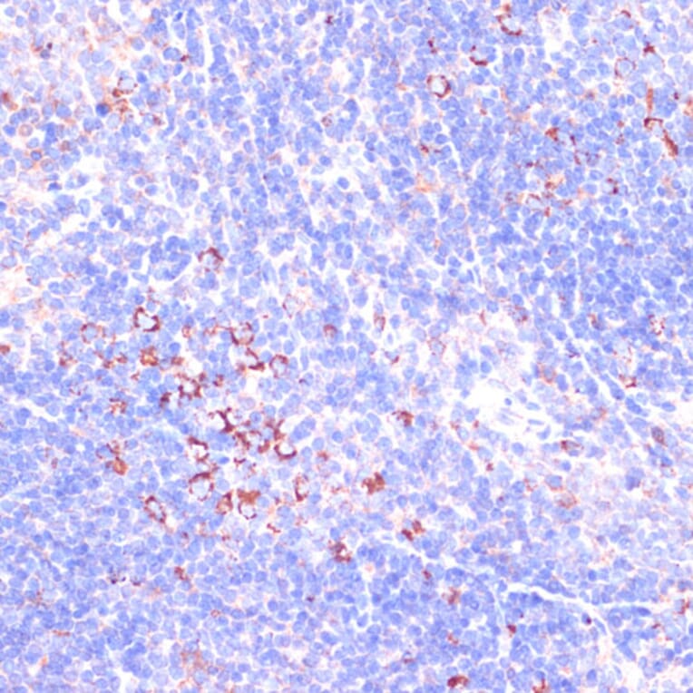 Immunohistochemistry - Anti-Zyxin Antibody (A13900) - Antibodies.com