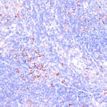 Immunohistochemistry - Anti-Zyxin Antibody (A13900) - Antibodies.com