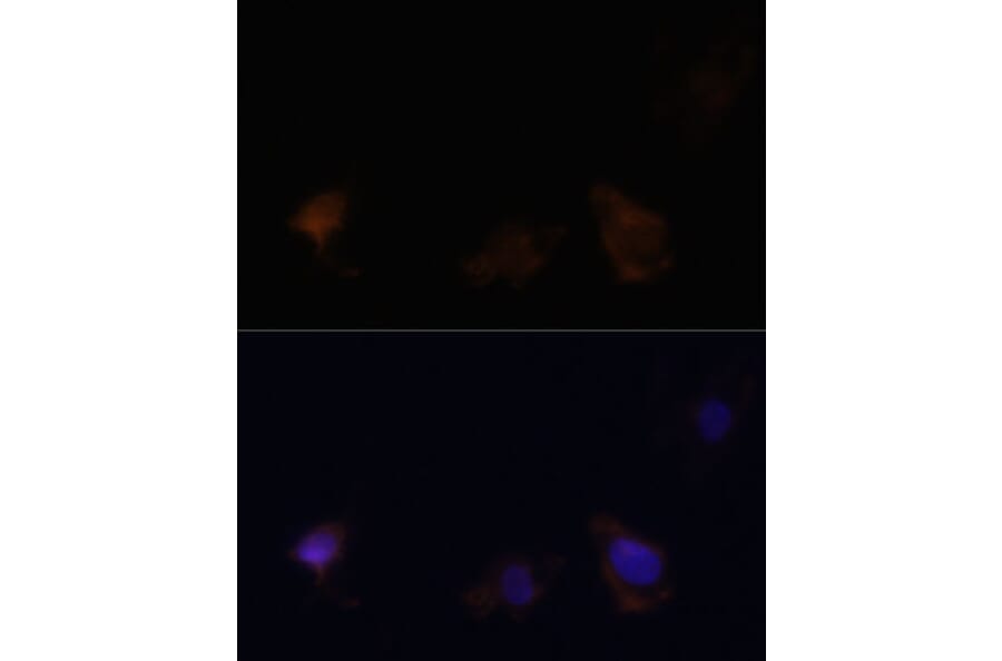 Immunofluorescence - Anti-Zyxin Antibody (A13900) - Antibodies.com