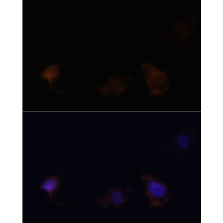 Immunofluorescence - Anti-Zyxin Antibody (A13900) - Antibodies.com