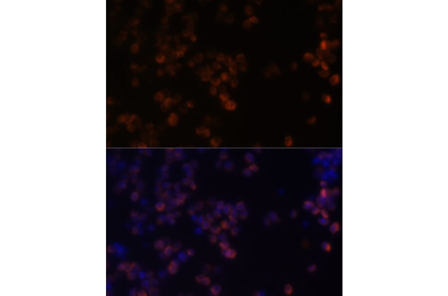 Immunofluorescence - Anti-Zyxin Antibody (A13900) - Antibodies.com