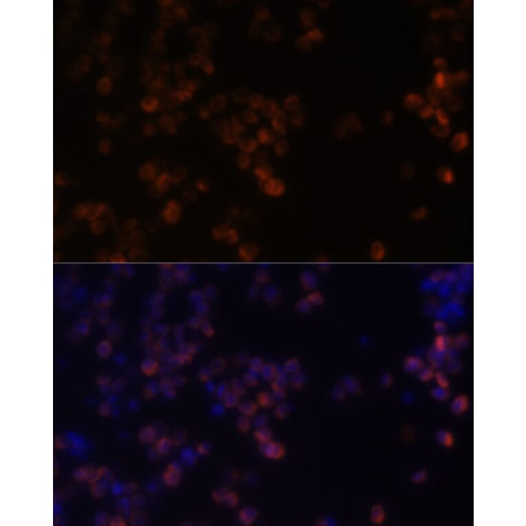 Immunofluorescence - Anti-Zyxin Antibody (A13900) - Antibodies.com