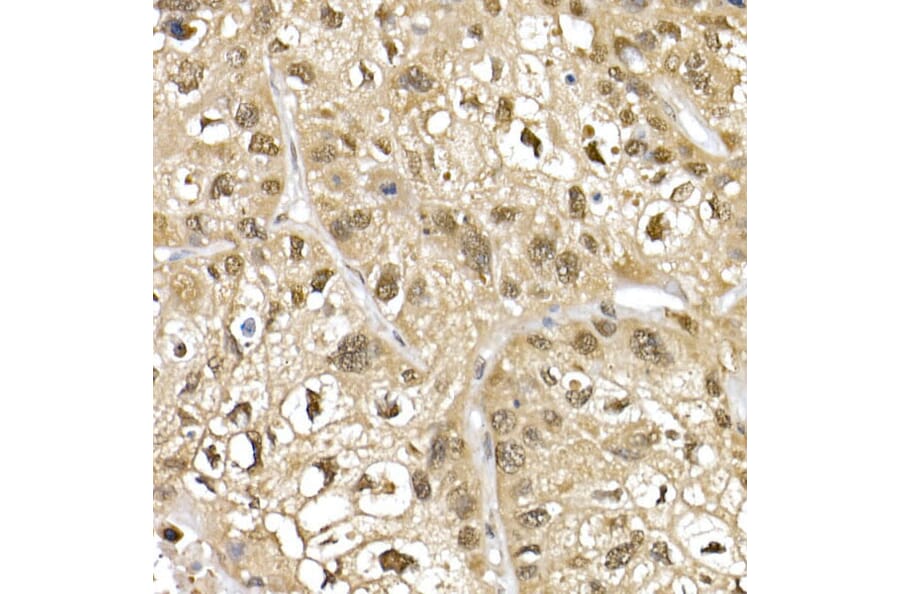Immunohistochemistry - Anti-Cullin 1/CUL-1 Antibody (A13901) - Antibodies.com