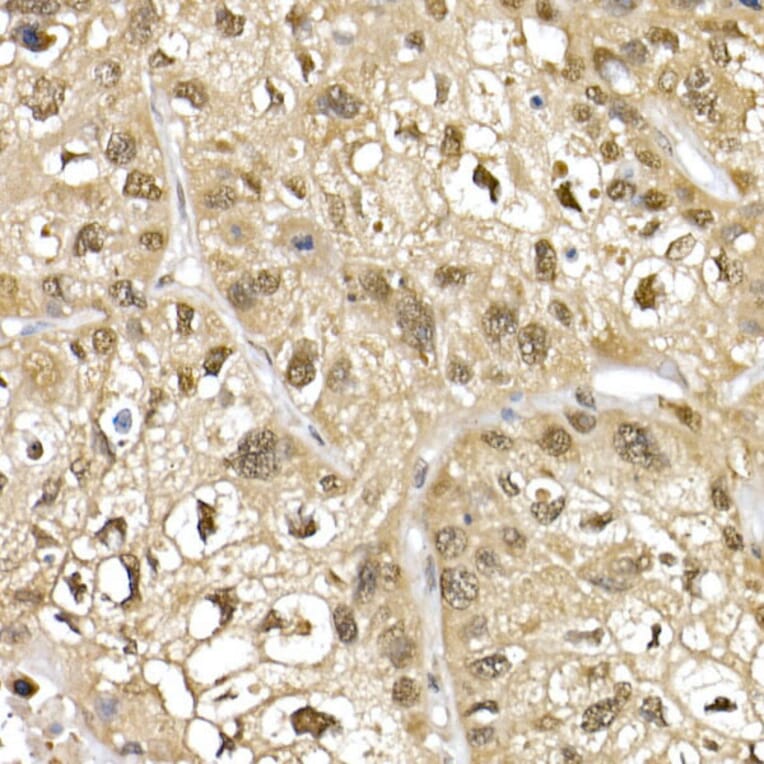 Immunohistochemistry - Anti-Cullin 1/CUL-1 Antibody (A13901) - Antibodies.com