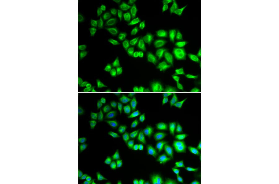 Immunofluorescence - Anti-Cullin 1/CUL-1 Antibody (A13901) - Antibodies.com