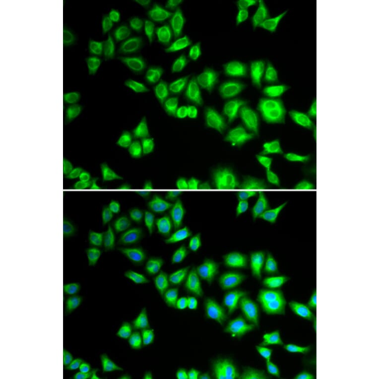 Immunofluorescence - Anti-Cullin 1/CUL-1 Antibody (A13901) - Antibodies.com