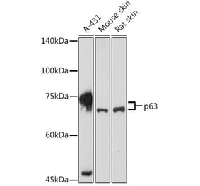 Western Blot - Anti-p63 Antibody (A13902) - Antibodies.com
