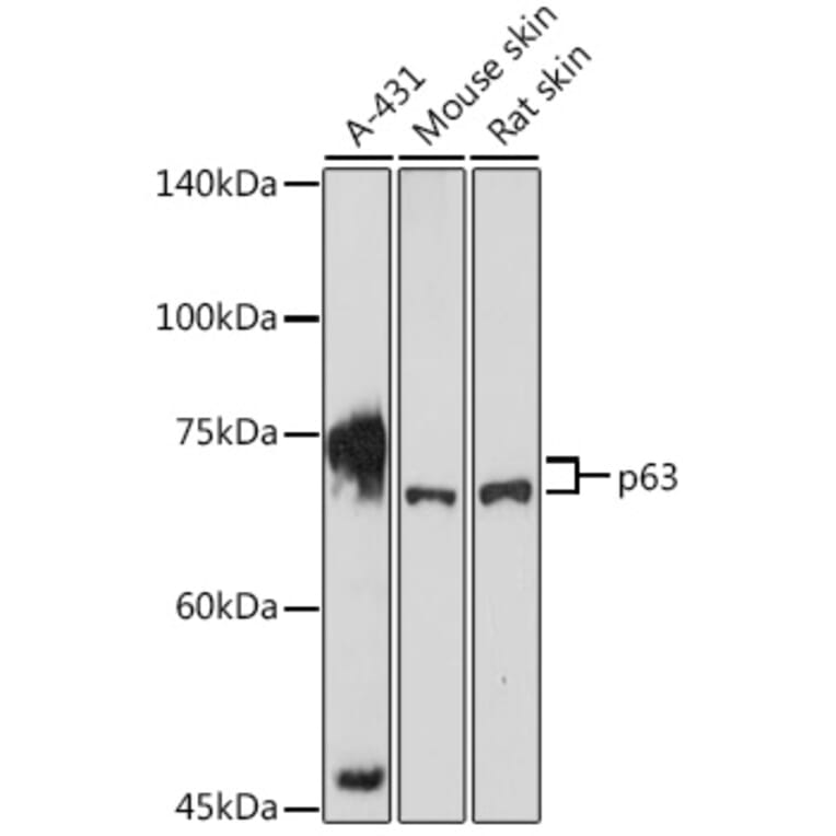 Western Blot - Anti-p63 Antibody (A13902) - Antibodies.com