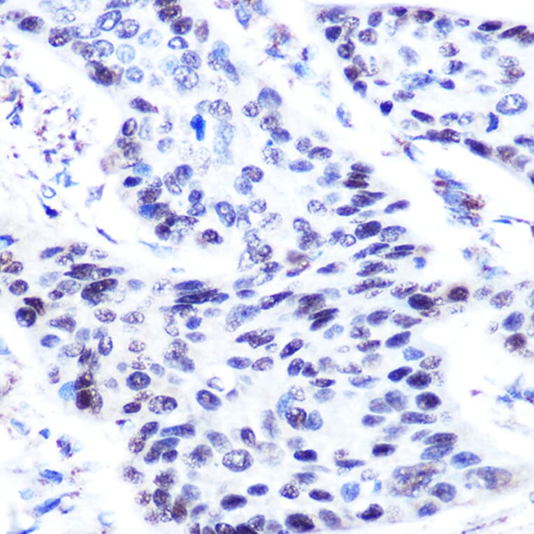 Immunohistochemistry - Anti-p63 Antibody (A13902) - Antibodies.com