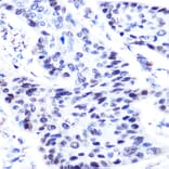 Immunohistochemistry - Anti-p63 Antibody (A13902) - Antibodies.com