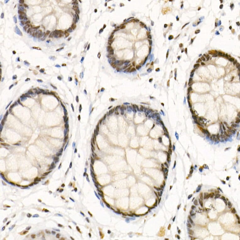 Immunohistochemistry - Anti-HDAC3 Antibody (A13903) - Antibodies.com