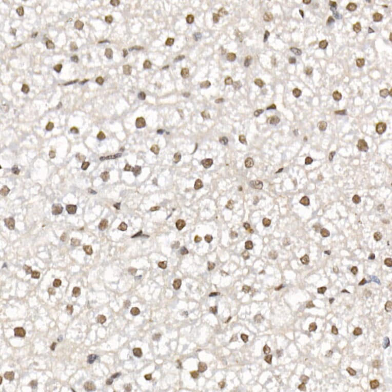 Immunohistochemistry - Anti-HDAC3 Antibody (A13903) - Antibodies.com