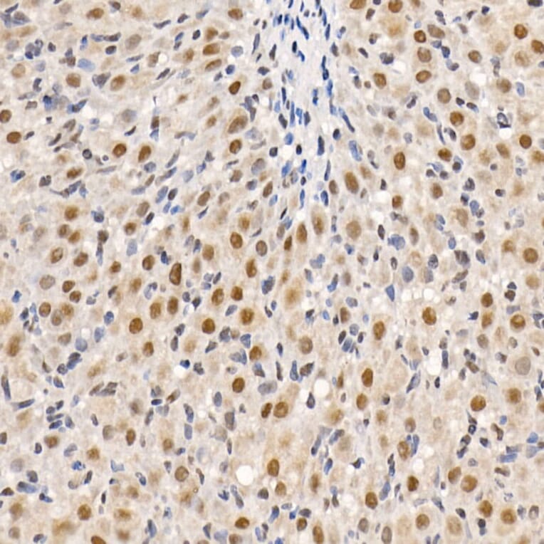 Immunohistochemistry - Anti-HDAC3 Antibody (A13903) - Antibodies.com
