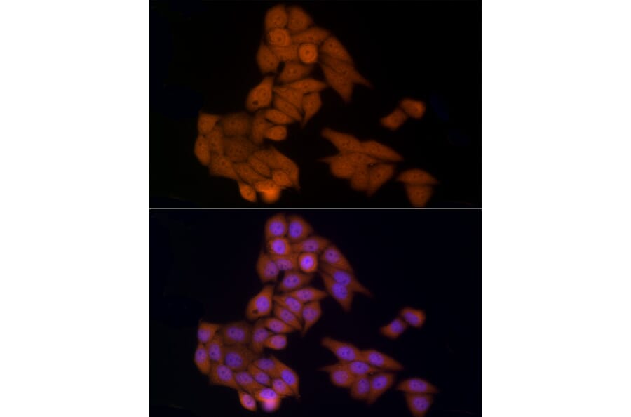 Immunofluorescence - Anti-HDAC3 Antibody (A13903) - Antibodies.com