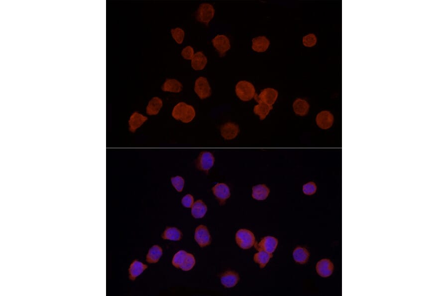 Immunofluorescence - Anti-HDAC3 Antibody (A13903) - Antibodies.com