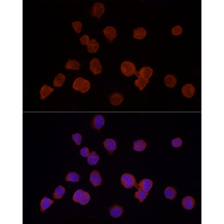 Immunofluorescence - Anti-HDAC3 Antibody (A13903) - Antibodies.com