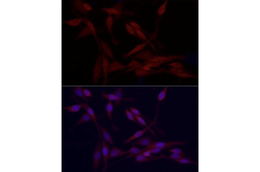 Immunofluorescence - Anti-HDAC3 Antibody (A13903) - Antibodies.com