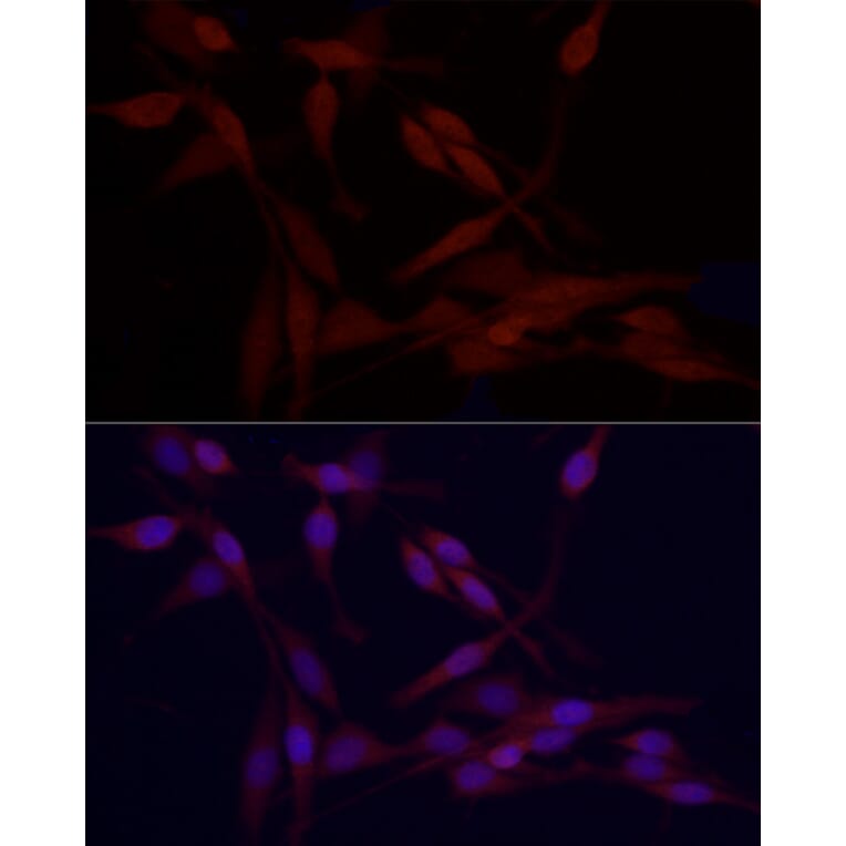 Immunofluorescence - Anti-HDAC3 Antibody (A13903) - Antibodies.com