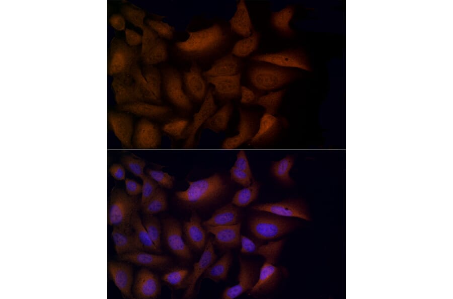 Immunofluorescence - Anti-HDAC3 Antibody (A13903) - Antibodies.com