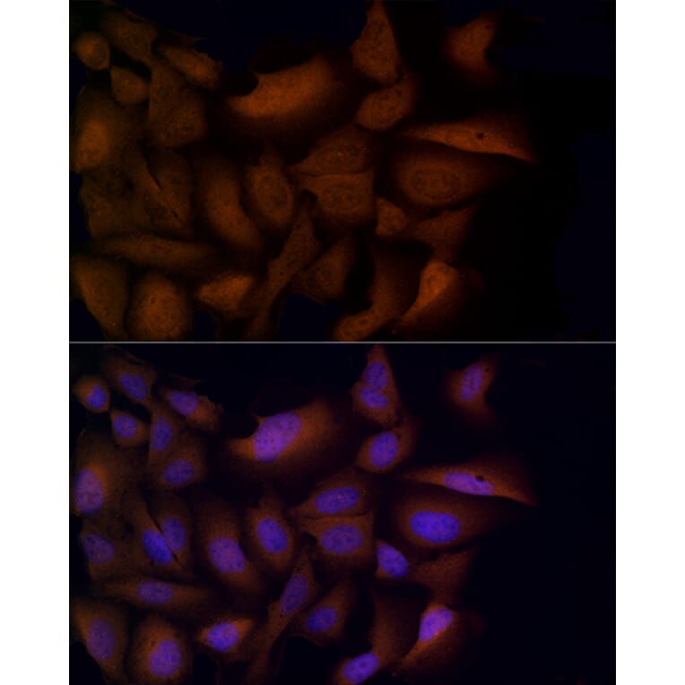 Immunofluorescence - Anti-HDAC3 Antibody (A13903) - Antibodies.com