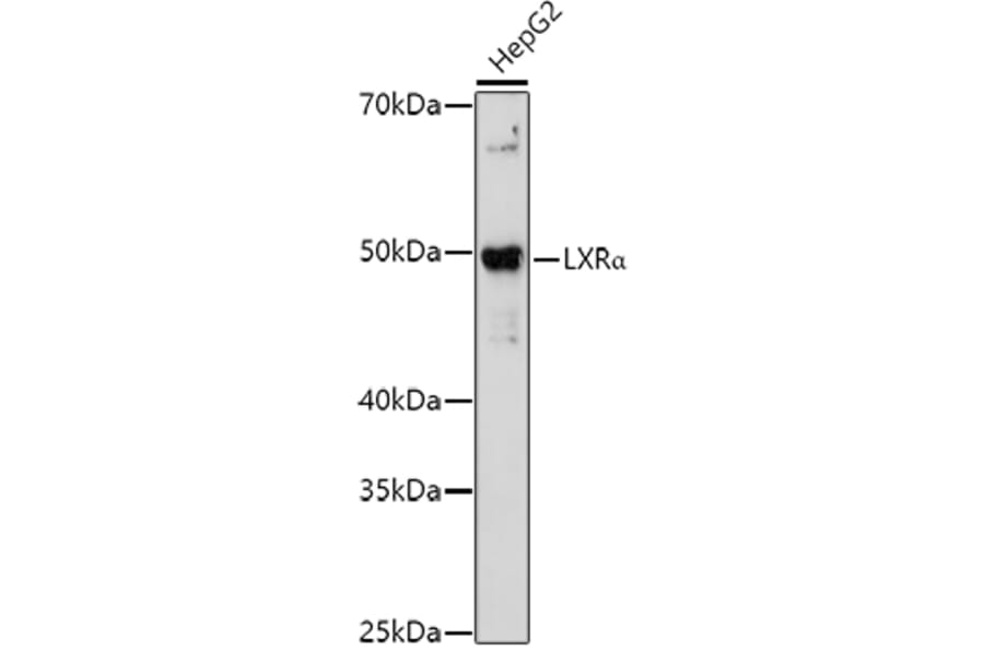 Western Blot - Anti-LXR alpha Antibody (A13904) - Antibodies.com
