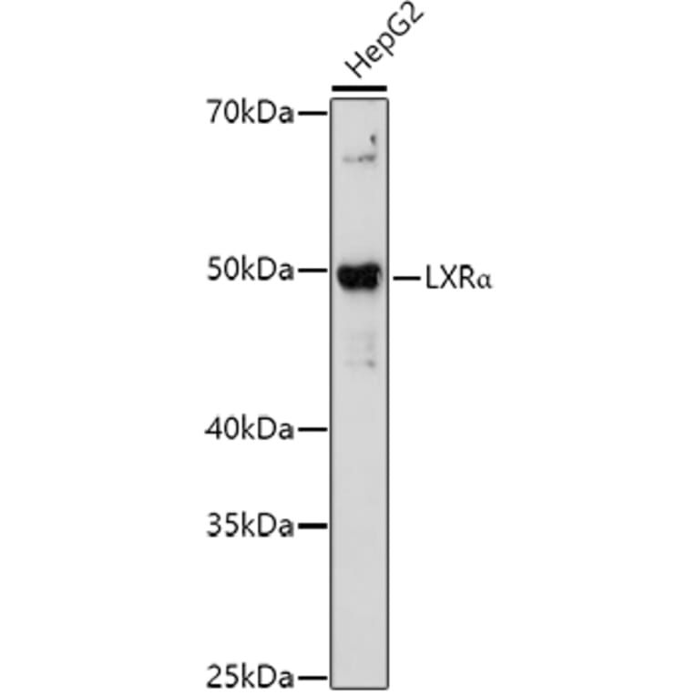 Western Blot - Anti-LXR alpha Antibody (A13904) - Antibodies.com