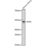 Western Blot - Anti-LXR alpha Antibody (A13904) - Antibodies.com