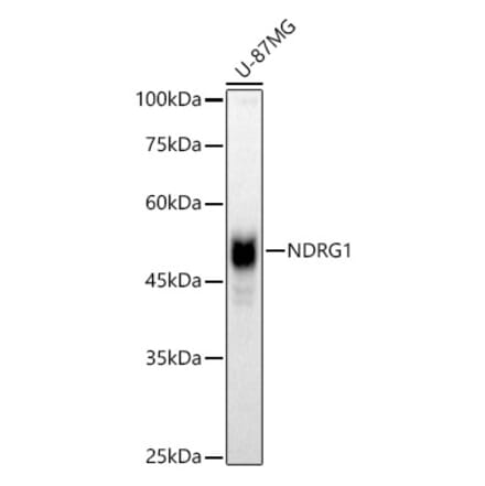Western Blot - Anti-NDRG1 Antibody (A13905) - Antibodies.com