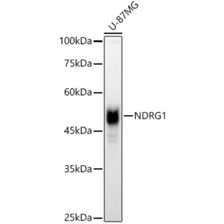 Western Blot - Anti-NDRG1 Antibody (A13905) - Antibodies.com