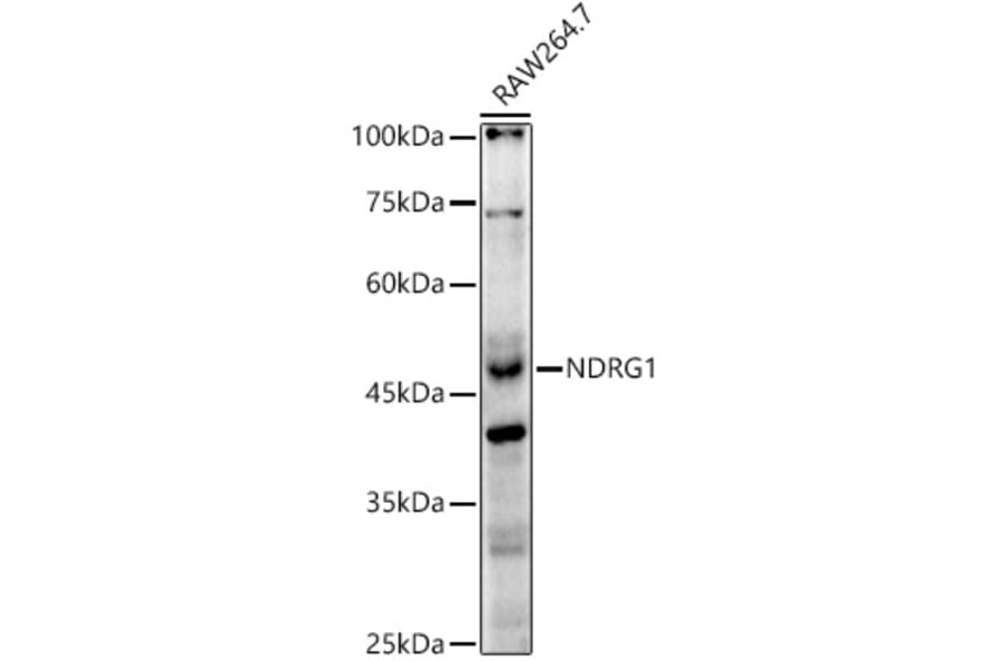 Western Blot - Anti-NDRG1 Antibody (A13905) - Antibodies.com