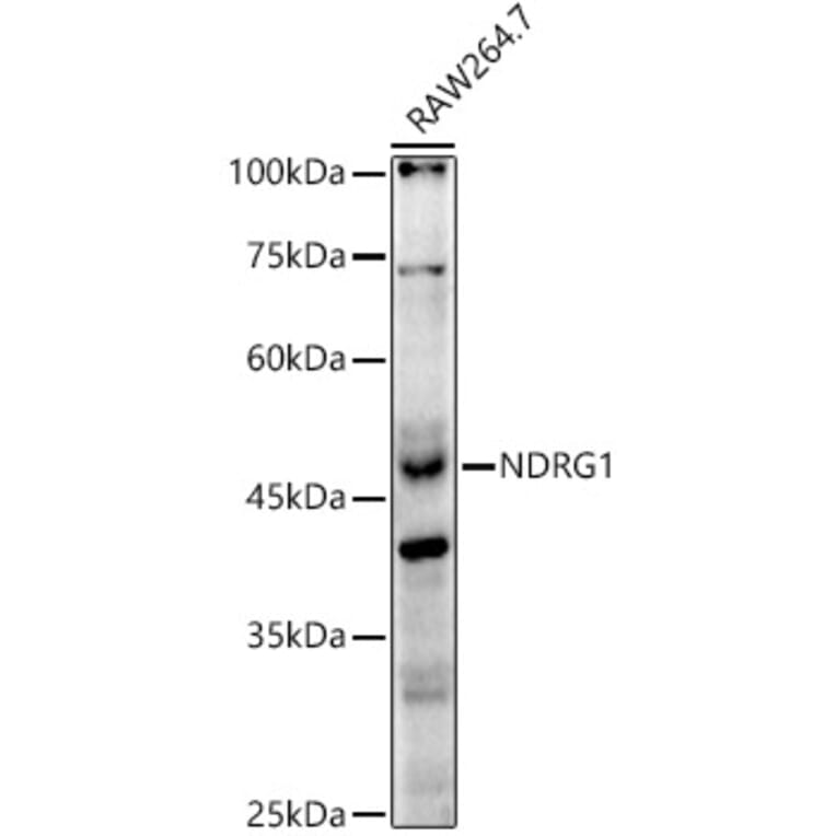 Western Blot - Anti-NDRG1 Antibody (A13905) - Antibodies.com