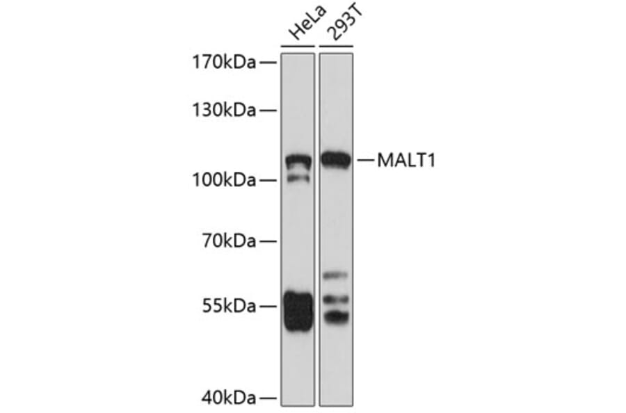 Western Blot - Anti-MALT1/MLT Antibody (A13907) - Antibodies.com